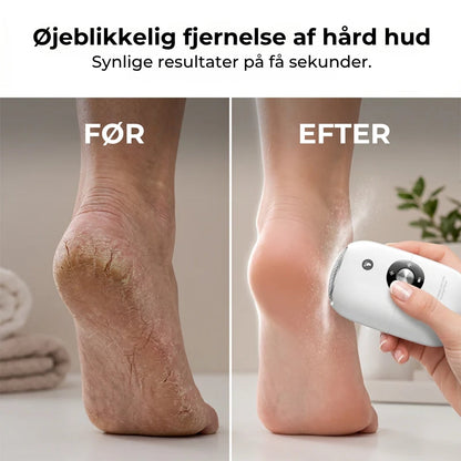 Bærbar elektrisk fodfil